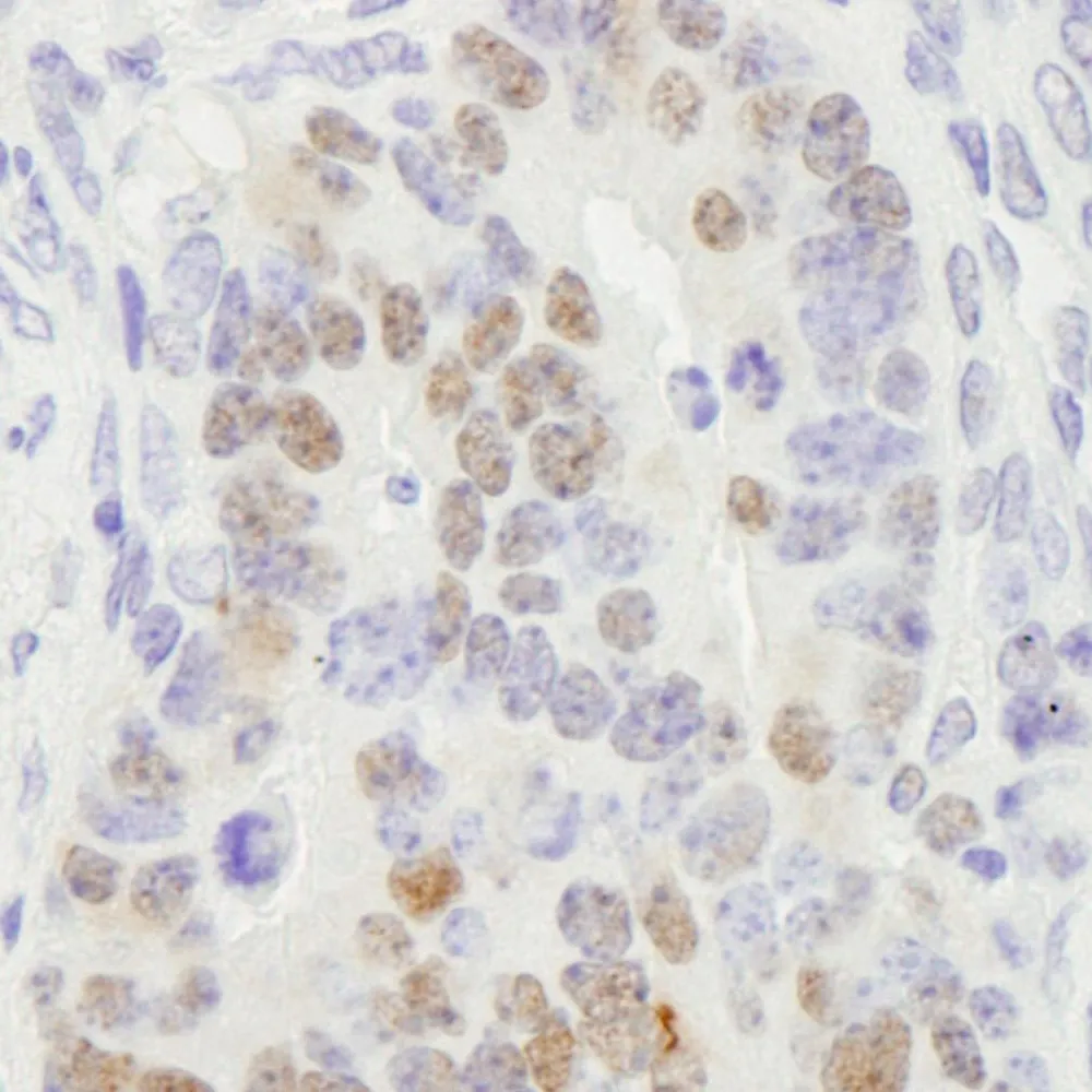 Rabbit anti-RCC2 IHC Antibody, Affinity Purified