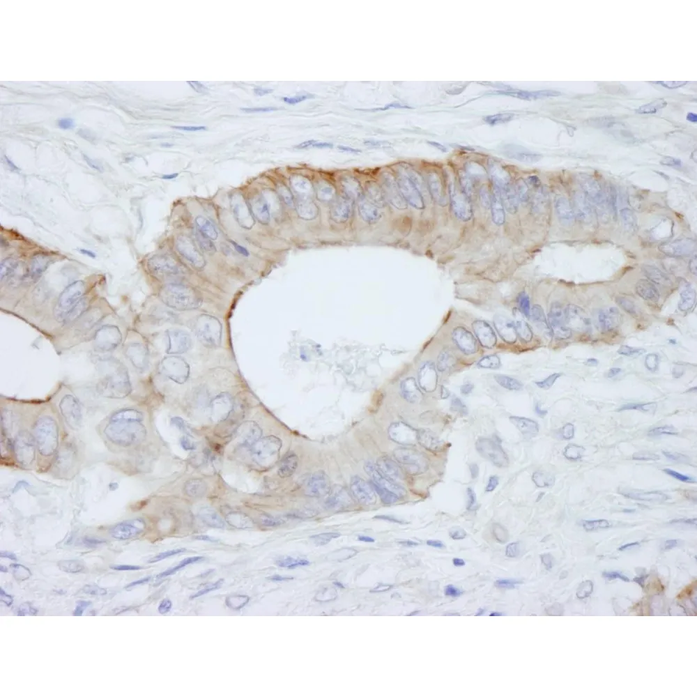 Rabbit anti-SPTBN1 IHC Antibody, Affinity Purified