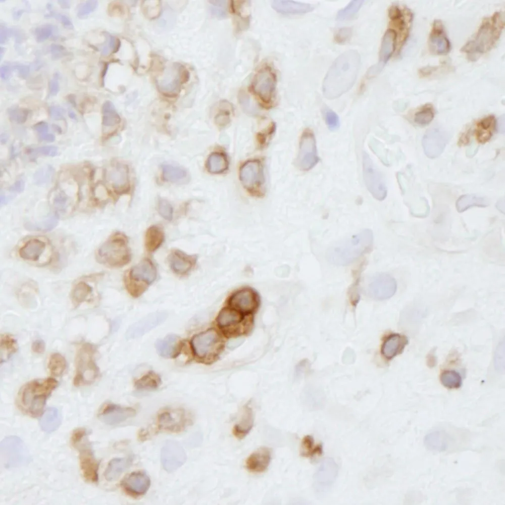 Rabbit anti-Coronin 1 IHC Antibody, Affinity Purified
