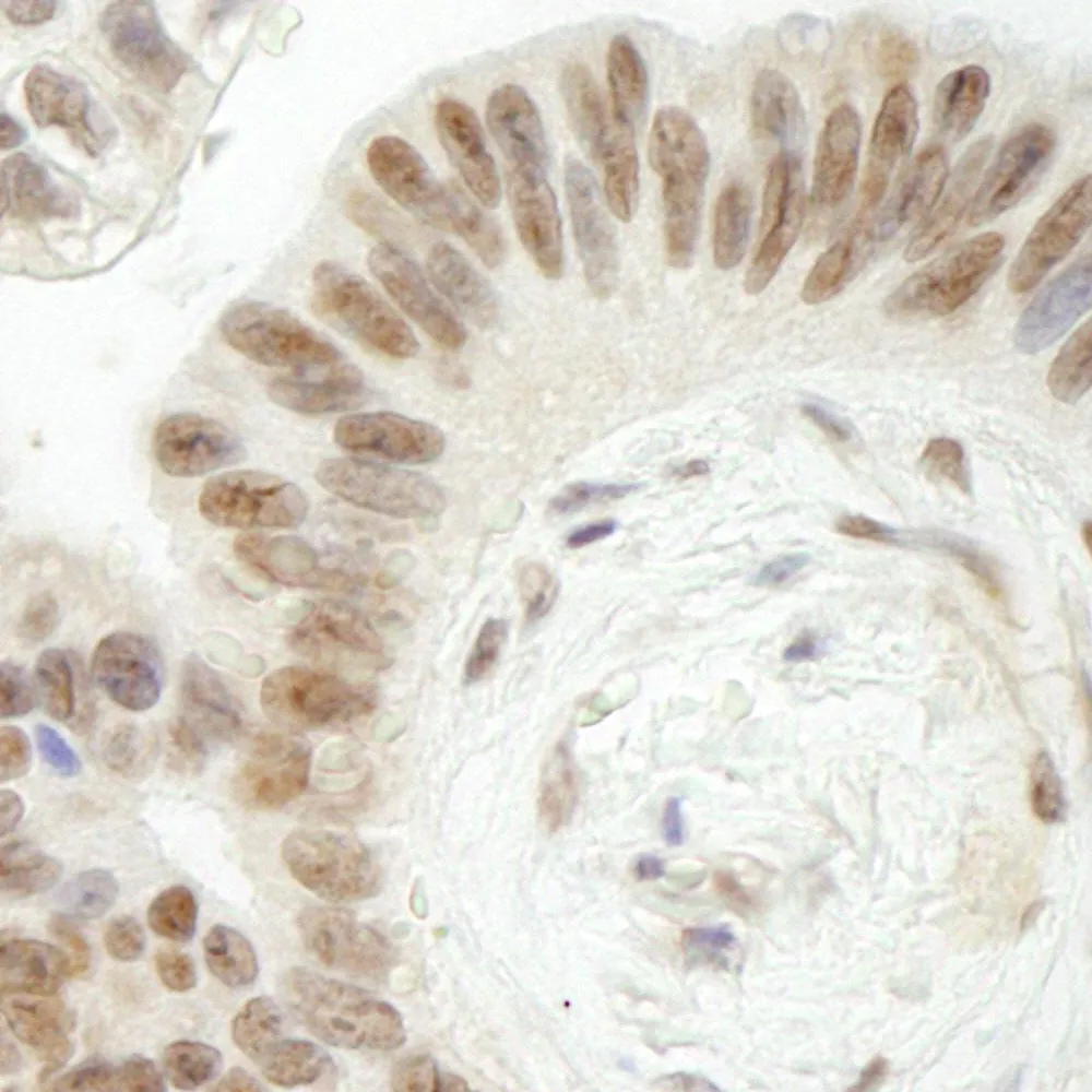 Rabbit anti-Topo II Beta IHC Antibody, Affinity Purified