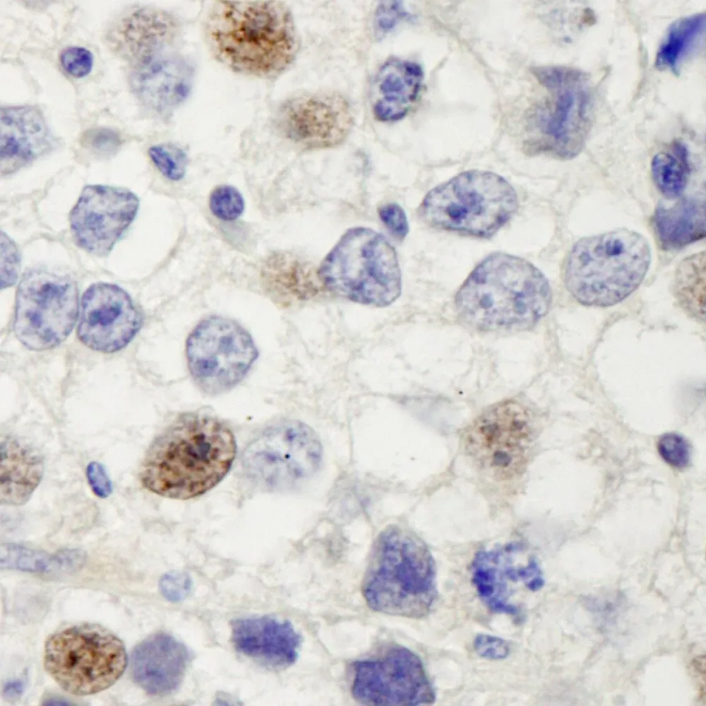 Rabbit anti-HURP/DLG7 IHC Antibody, Affinity Purified
