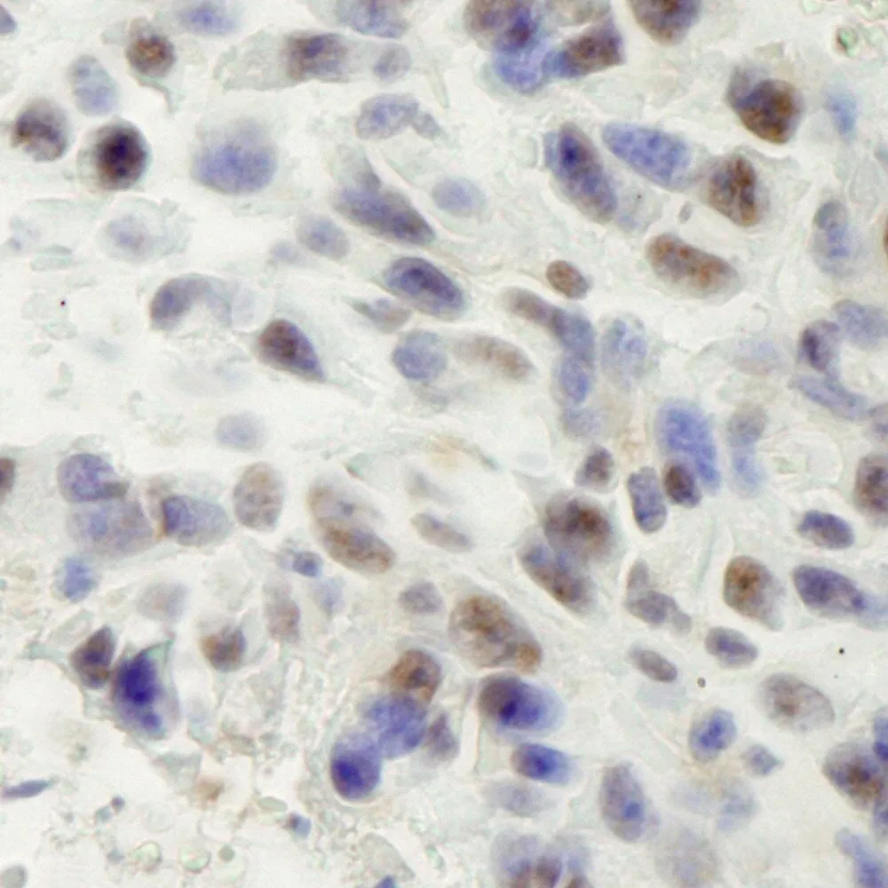 Rabbit anti-hSET1 IHC Antibody, Affinity Purified