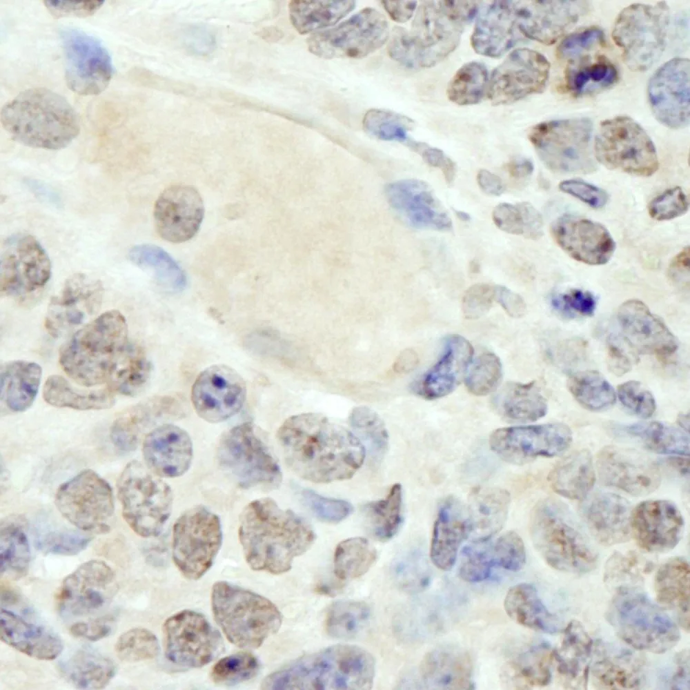 Rabbit anti-HMG2a IHC Antibody, Affinity Purified