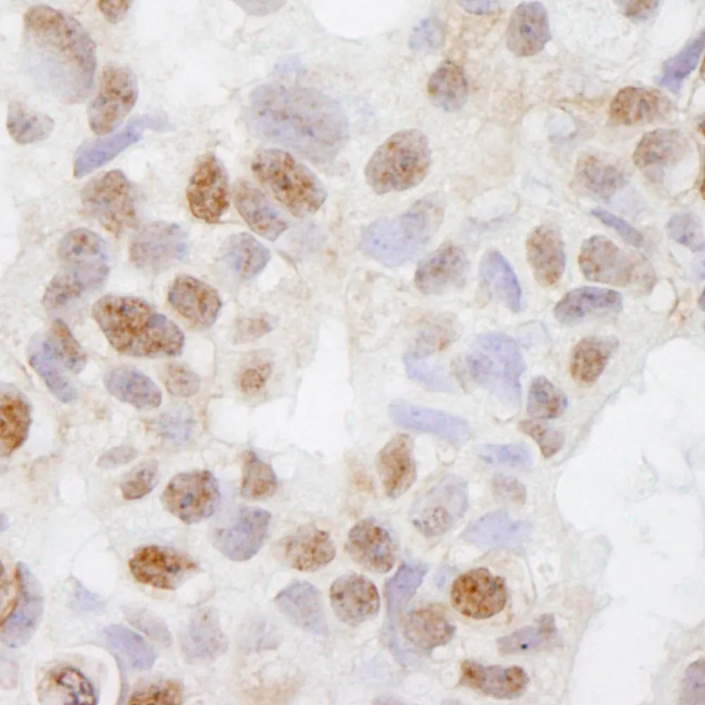 Rabbit anti-DHX38 IHC Antibody, Affinity Purified