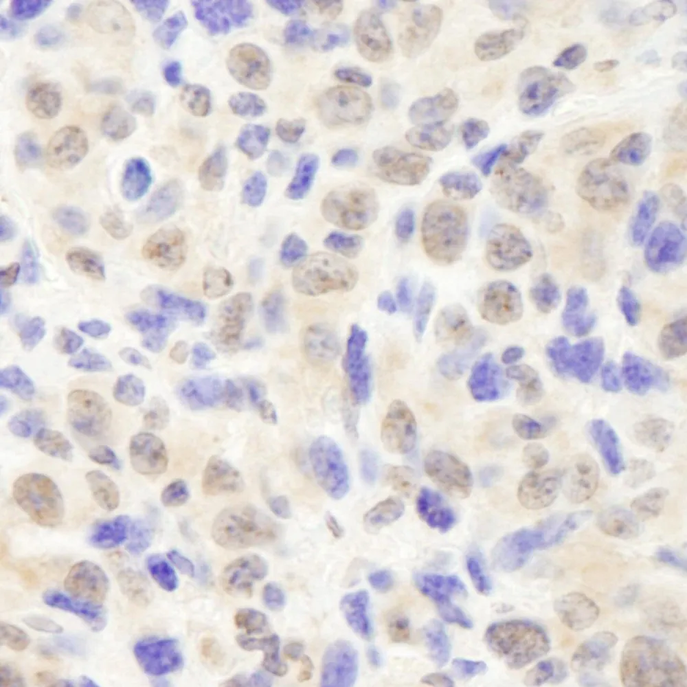 Rabbit anti-CSN2 IHC Antibody, Affinity Purified