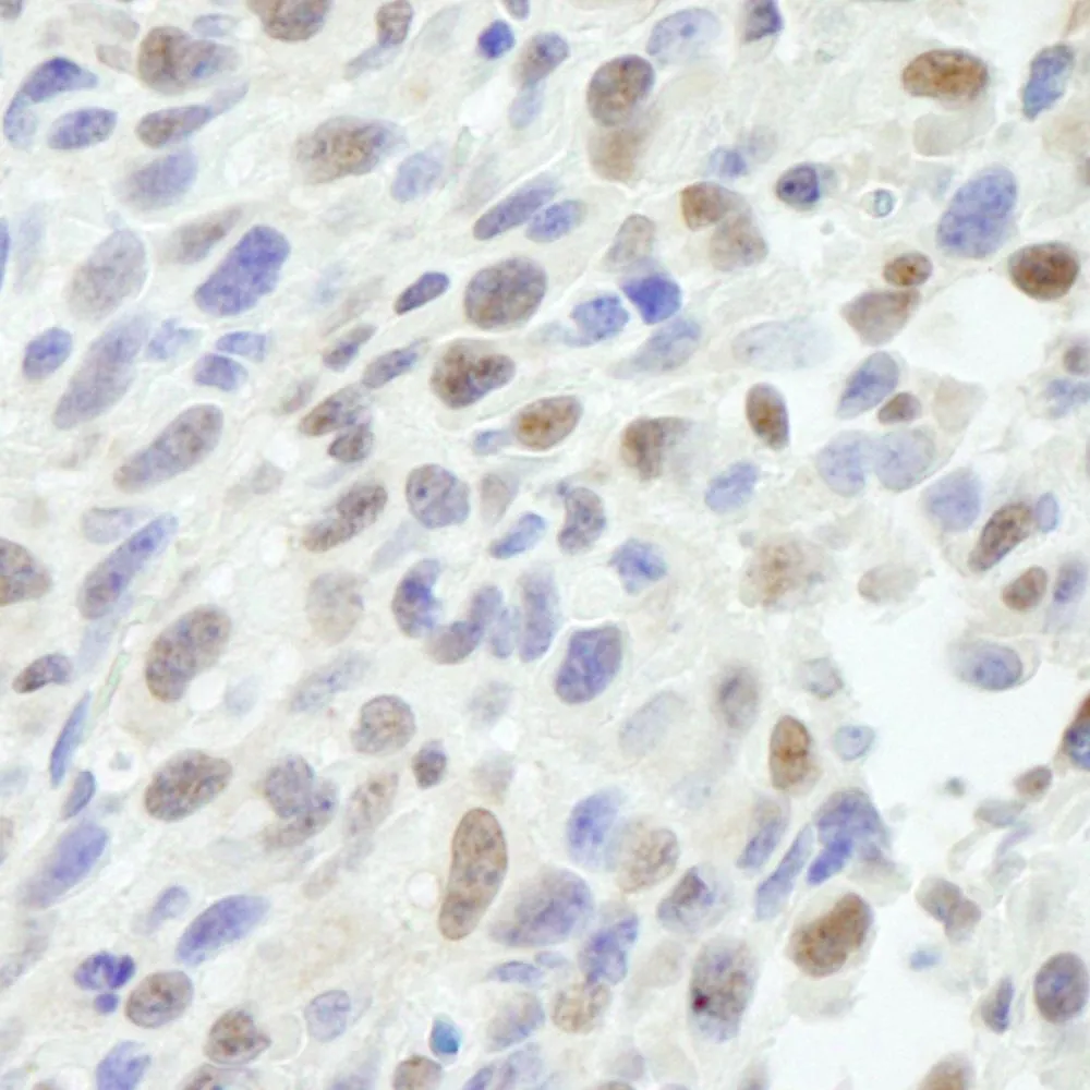 Rabbit anti-MED12 IHC Antibody, Affinity Purified