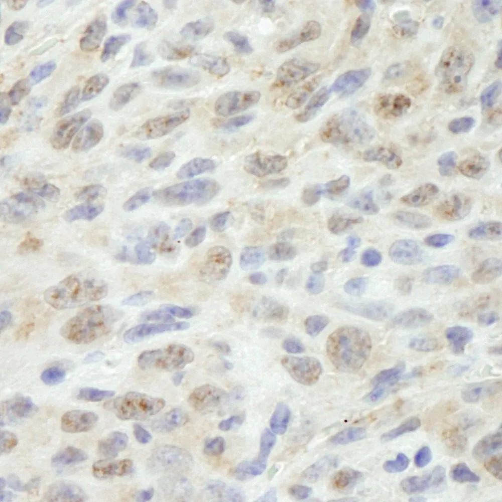 Rabbit anti-MED18 IHC Antibody, Affinity Purified