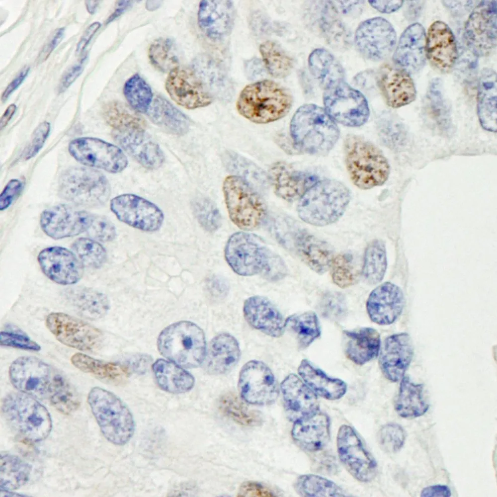 Rabbit anti-MAD1 IHC Antibody, Affinity Purified