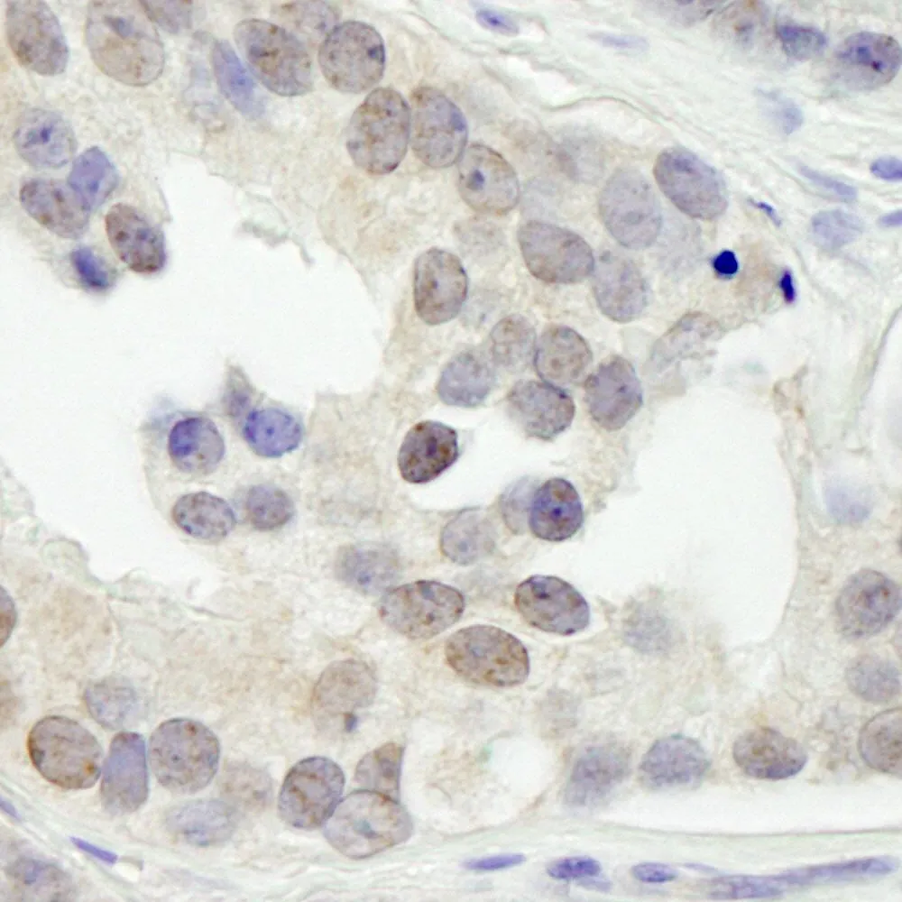 Rabbit anti-JMJD1B IHC Antibody, Affinity Purified