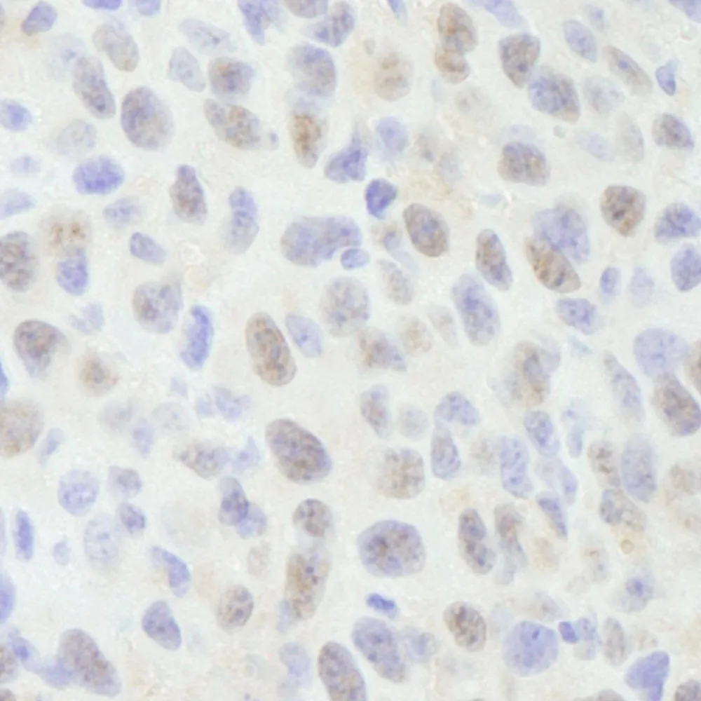 Rabbit anti-NCOA62 IHC Antibody, Affinity Purified