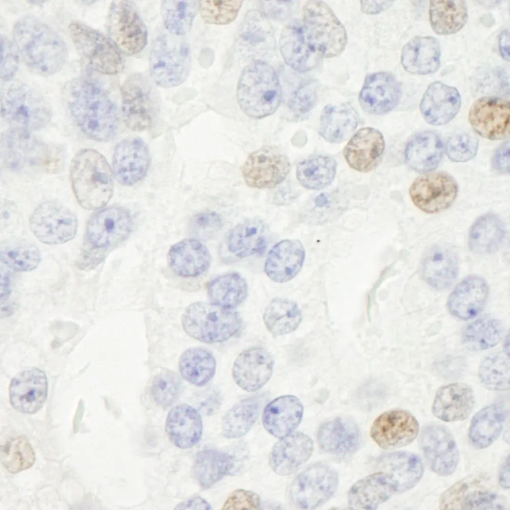 Rabbit anti-p14ARF IHC Antibody, Affinity Purified