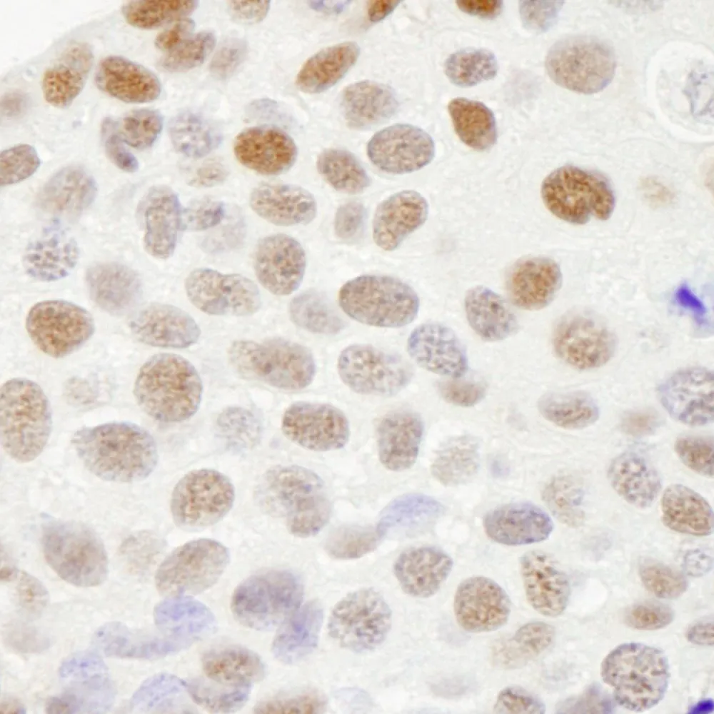 Rabbit anti-RecQ1 IHC Antibody, Affinity Purified