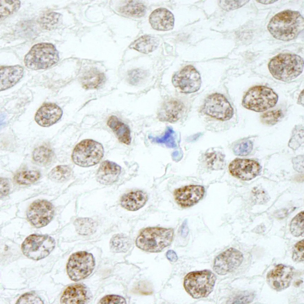 Rabbit anti-RIF1 IHC Antibody, Affinity Purified