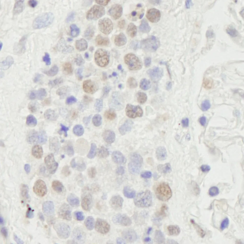 Rabbit anti-SUPT6H IHC Antibody, Affinity Purified