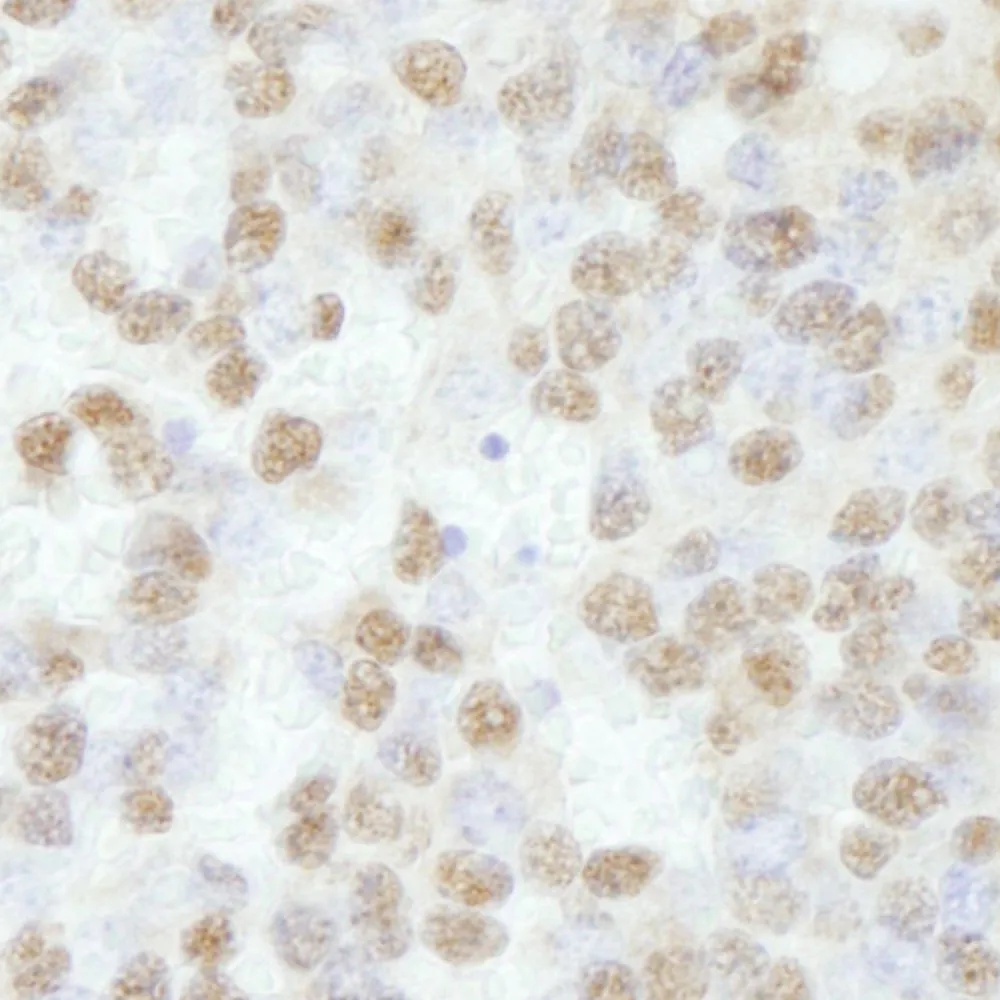 Rabbit anti-RBM16 IHC Antibody, affinity purified