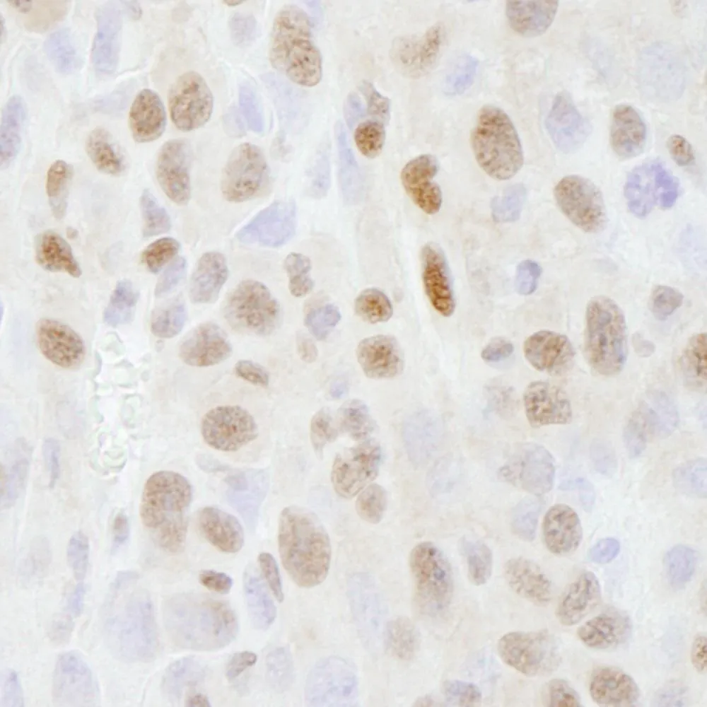 Rabbit anti-SMARCC2/BAF170 IHC Antibody, Affinity Purified