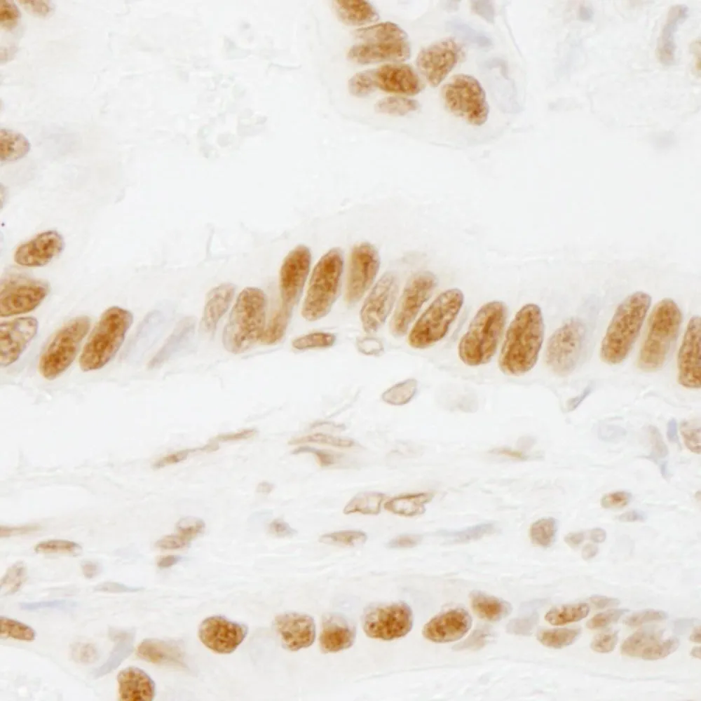 Rabbit anti-ACINUS/ACN1 IHC Antibody, Affinity Purified