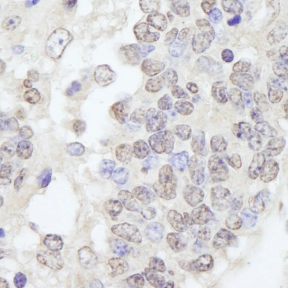Rabbit anti-TRIM33/TIF1gamma IHC Antibody, Affinity Purified