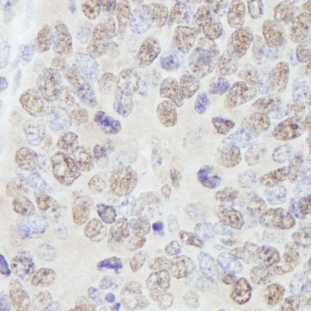 Rabbit anti-AKAP8/AKAP95 IHC Antibody, Affinity Purified