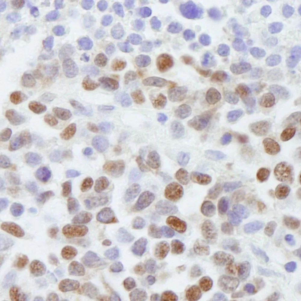 Rabbit anti-SAFB2 IHC Antibody, Affinity Purified