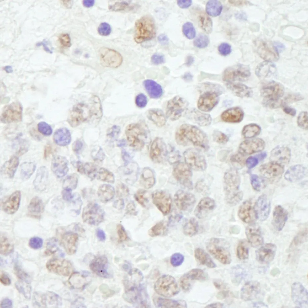 Rabbit anti-CSTF64 IHC Antibody, Affinity Purified
