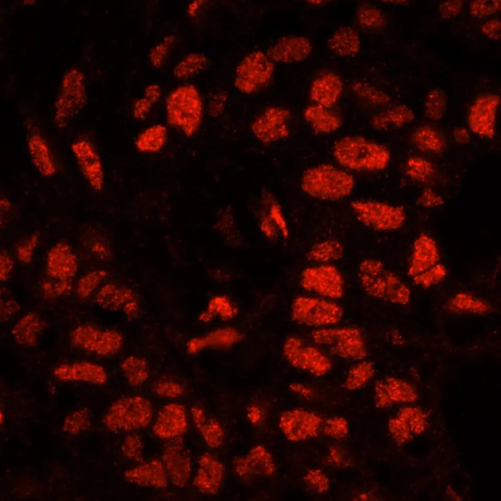 Rabbit anti-XRN2 IHC Antibody, Affinity Purified