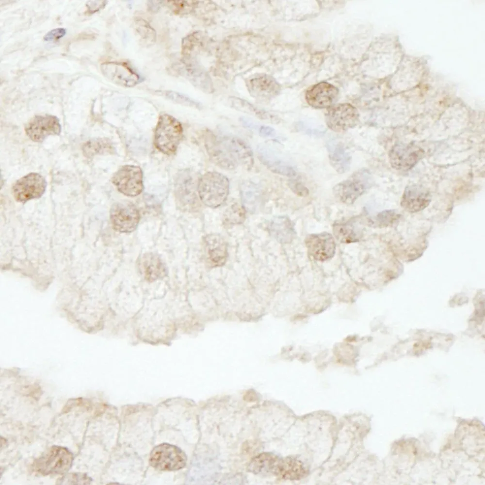 Rabbit anti-CAF-1 p60 IHC Antibody, Affinity Purified