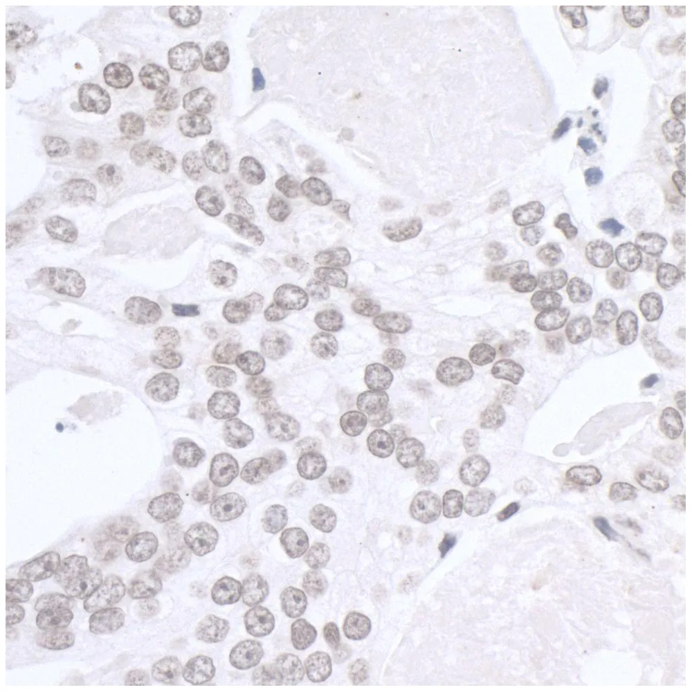 Rabbit anti-SMARCA1/SNF2L IHC Antibody, Affinity Purified