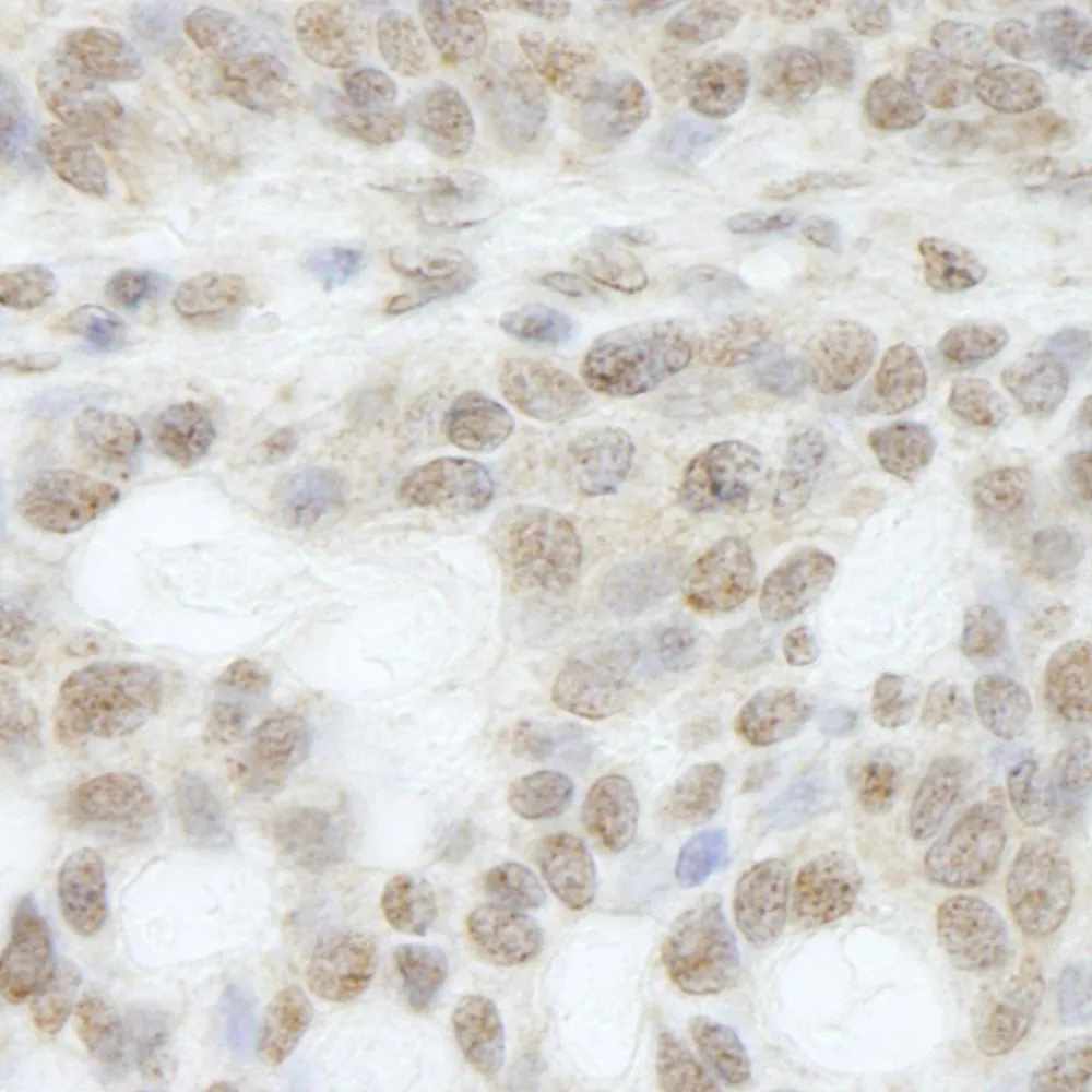 Rabbit anti-ATRX IHC Antibody, Affinity Purified