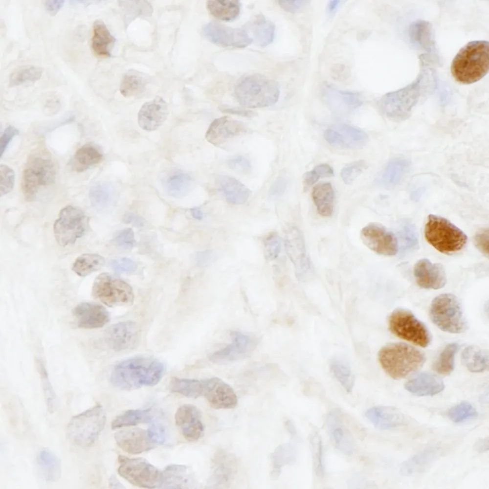 Rabbit anti-MAGED2 IHC Antibody, Affinity Purified