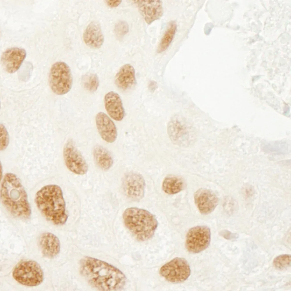 Rabbit anti-PML IHC Antibody, Affinity Purified
