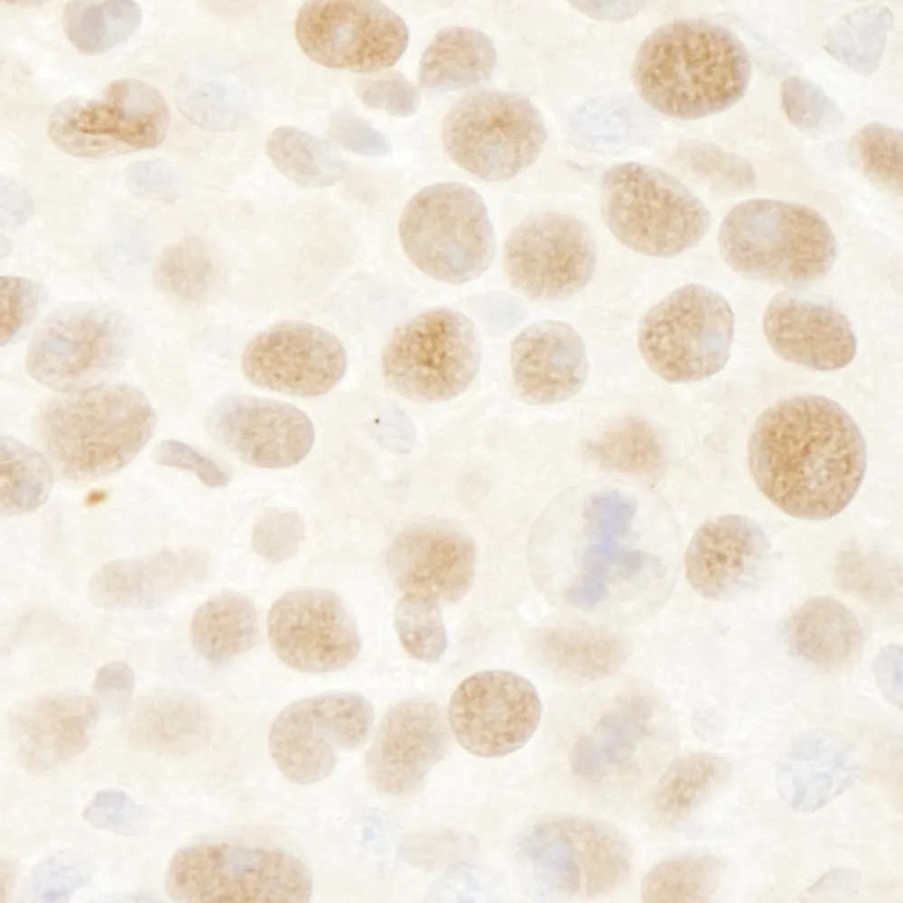 Rabbit anti-RbBP4 IHC Antibody, Affinity Purified