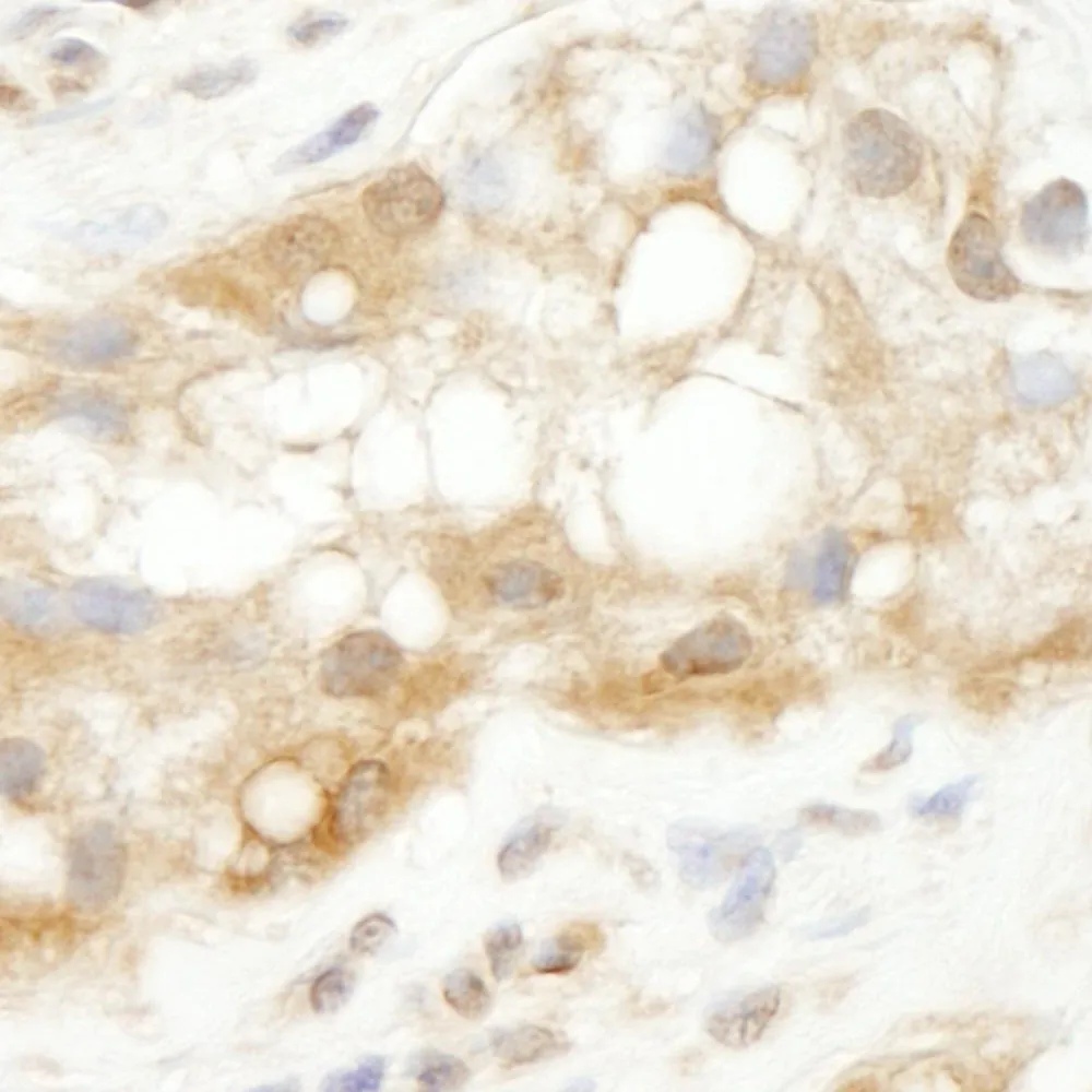 Rabbit anti-TRIM3/BERP IHC Antibody, Affinity Purified