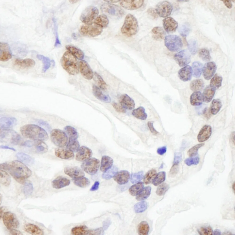 Rabbit anti-RBM26 IHC Antibody, Affinity Purified