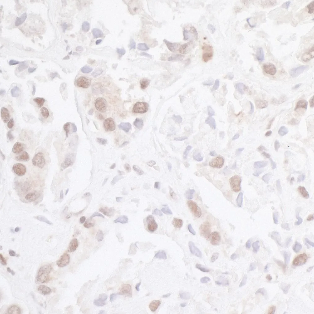 Rabbit anti-CHD8 IHC Antibody, Affinity Purified