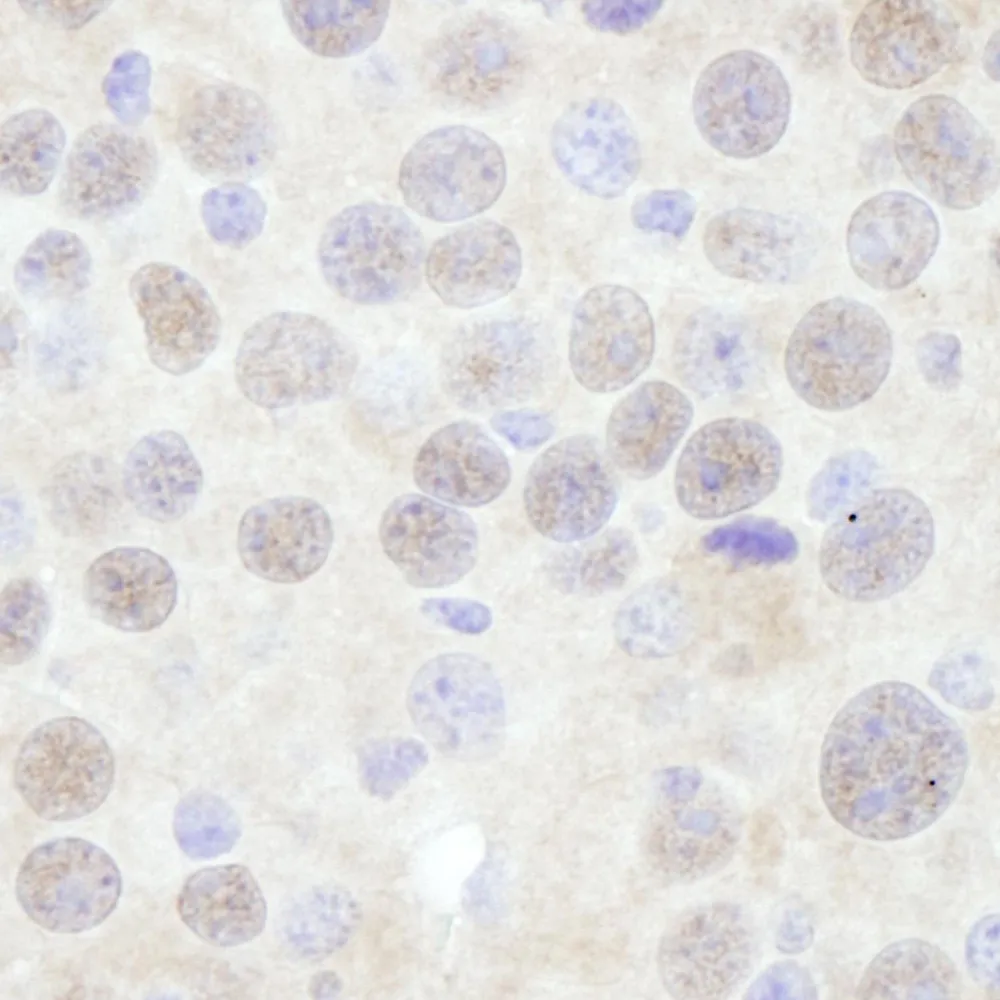 Rabbit anti-CHD3 IHC Antibody, Affinity Purified