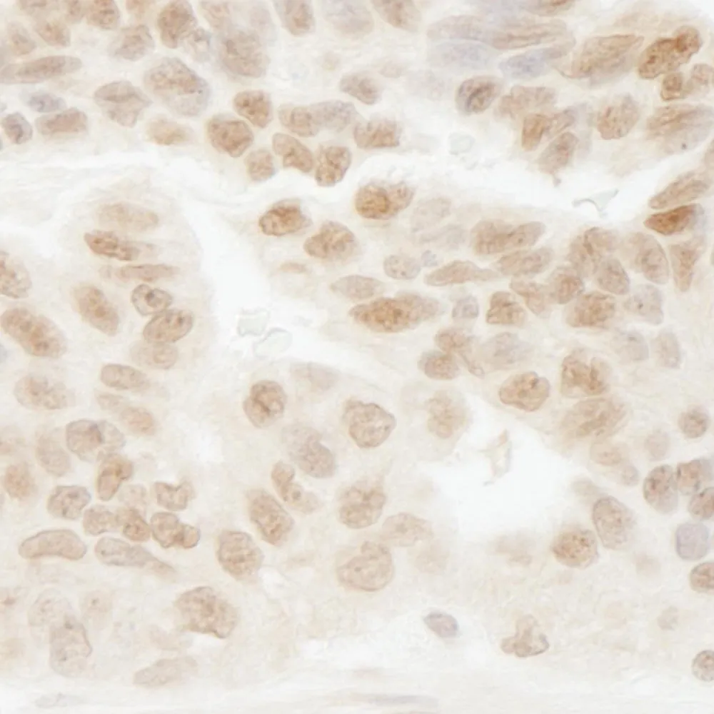Rabbit anti-CSTF50 IHC Antibody, Affinity Purified