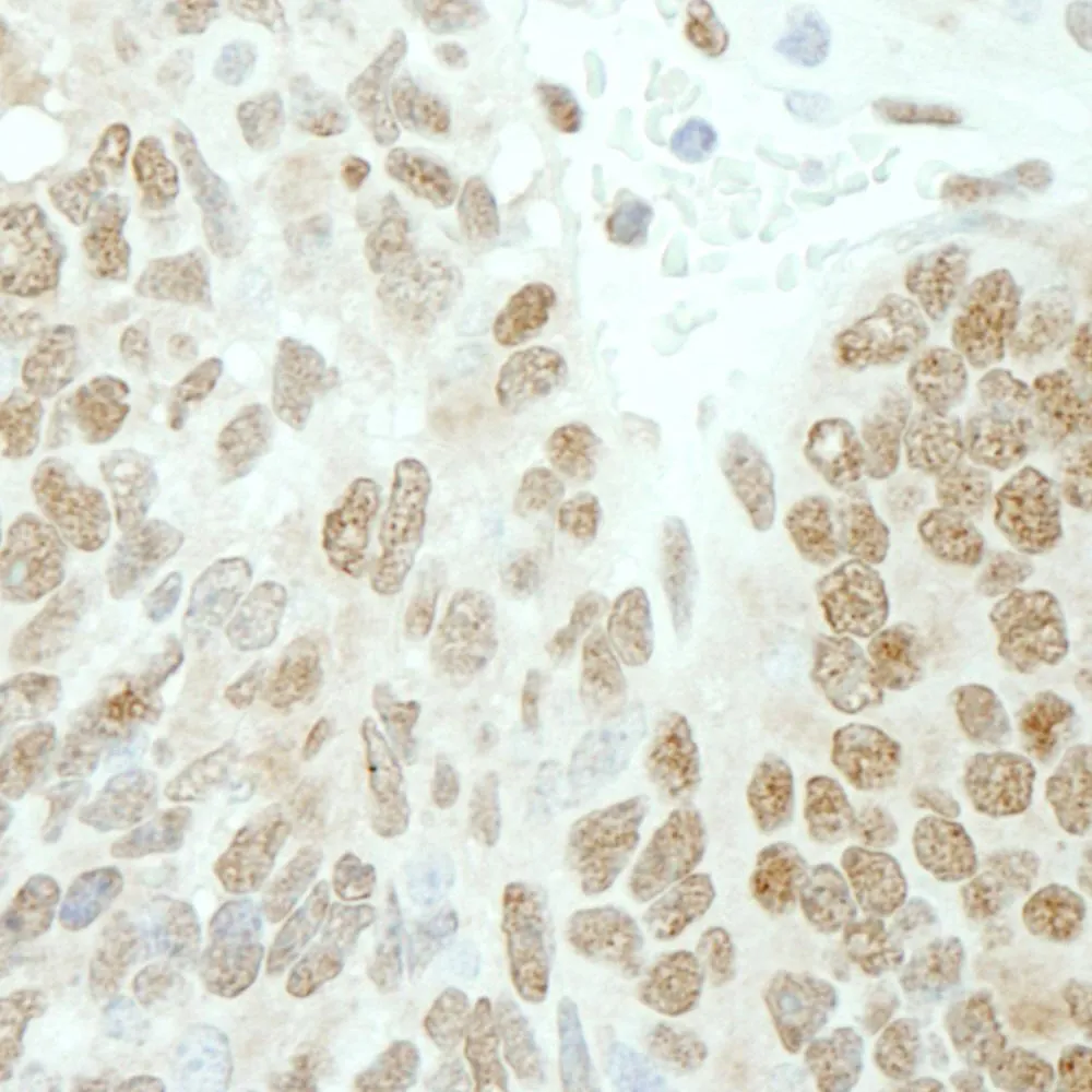 Rabbit anti-PolE3/p17 IHC Antibody, Affinity Purified