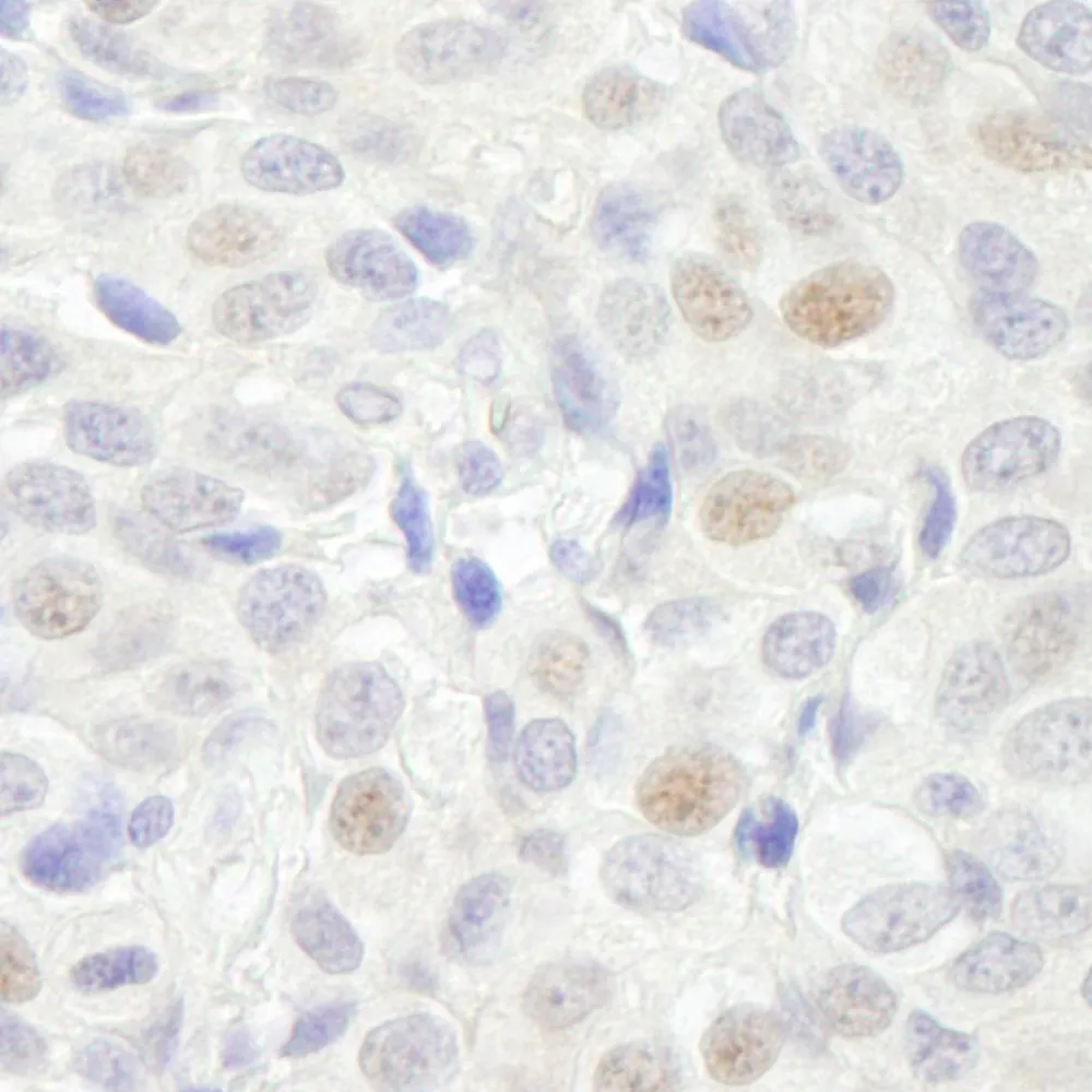Rabbit anti-GTF3C3/TFIII1C102 IHC Antibody, affinity purified