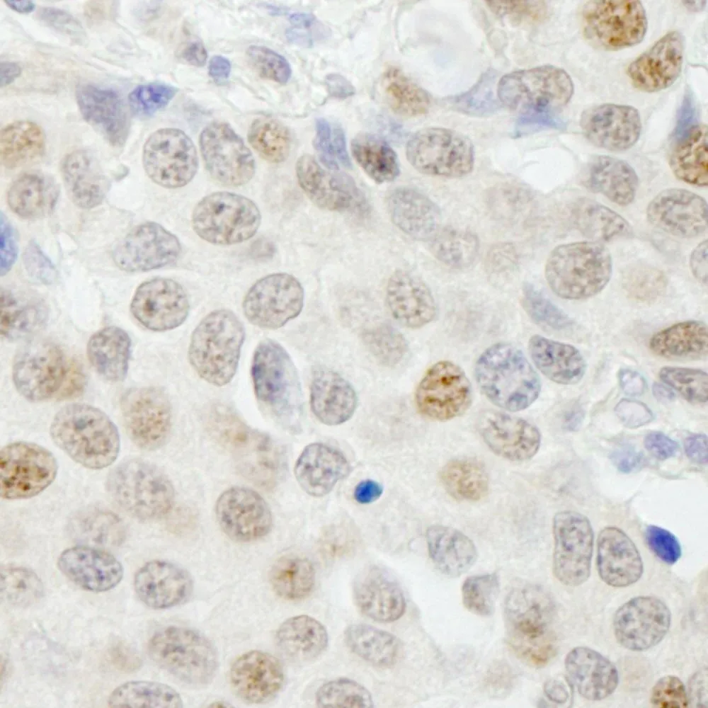 Rabbit anti-GTF3C4/TFIII1C90 IHC Antibody, affinity purified