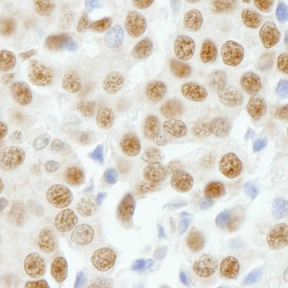 Rabbit anti-GTF3C5/TFIII1C63 IHC Antibody, affinity purified