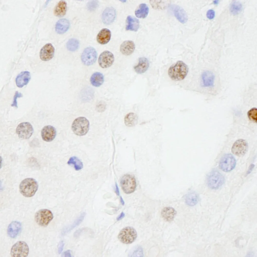 Rabbit anti-DDX54 IHC Antibody, affinity purified