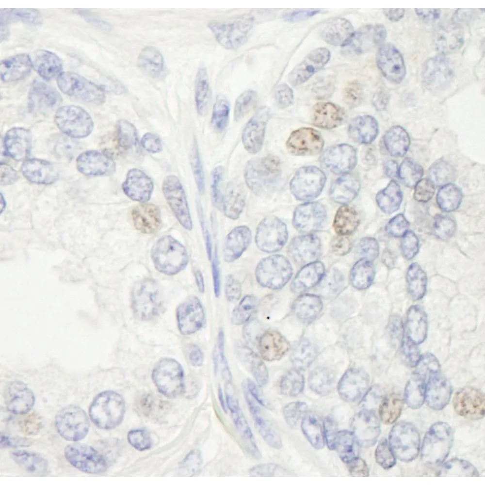 Rabbit anti-XPF/ERCC4 IHC Antibody, affinity purified