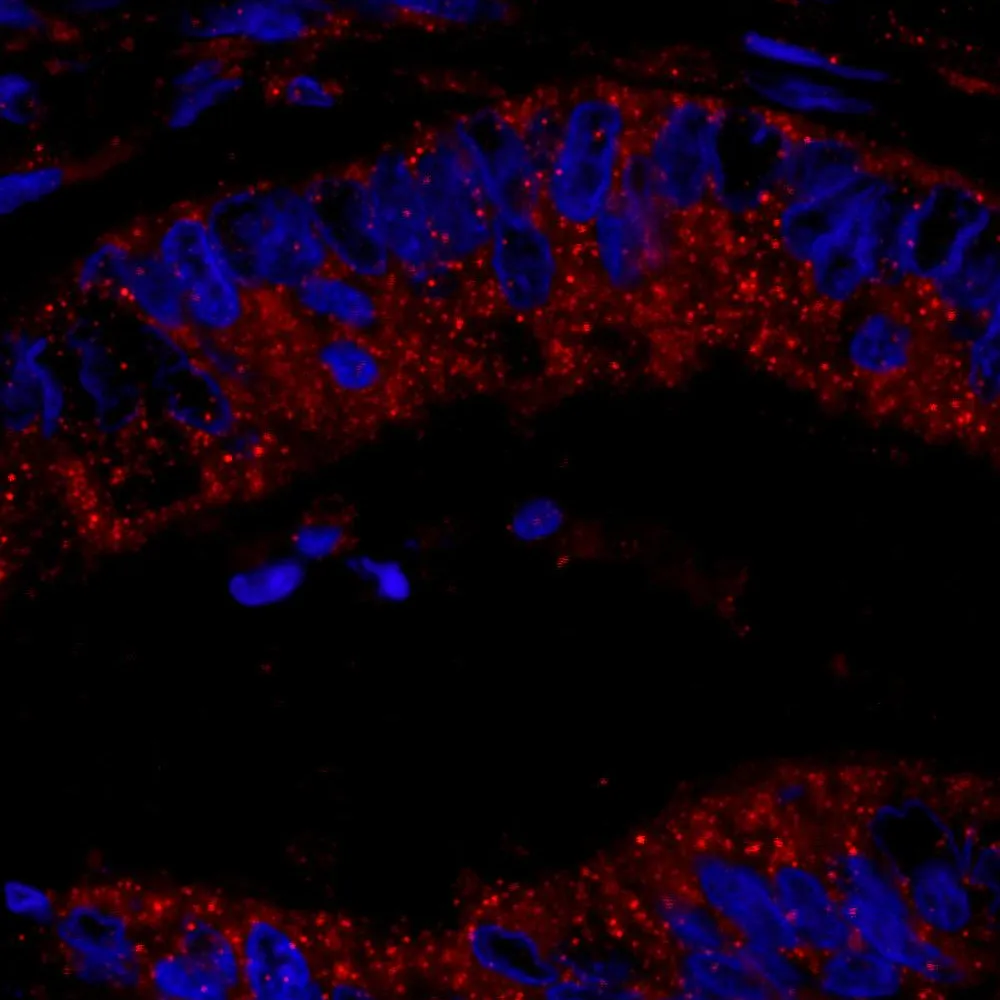 Rabbit anti-CIP2A IHC Antibody, Affinity Purified