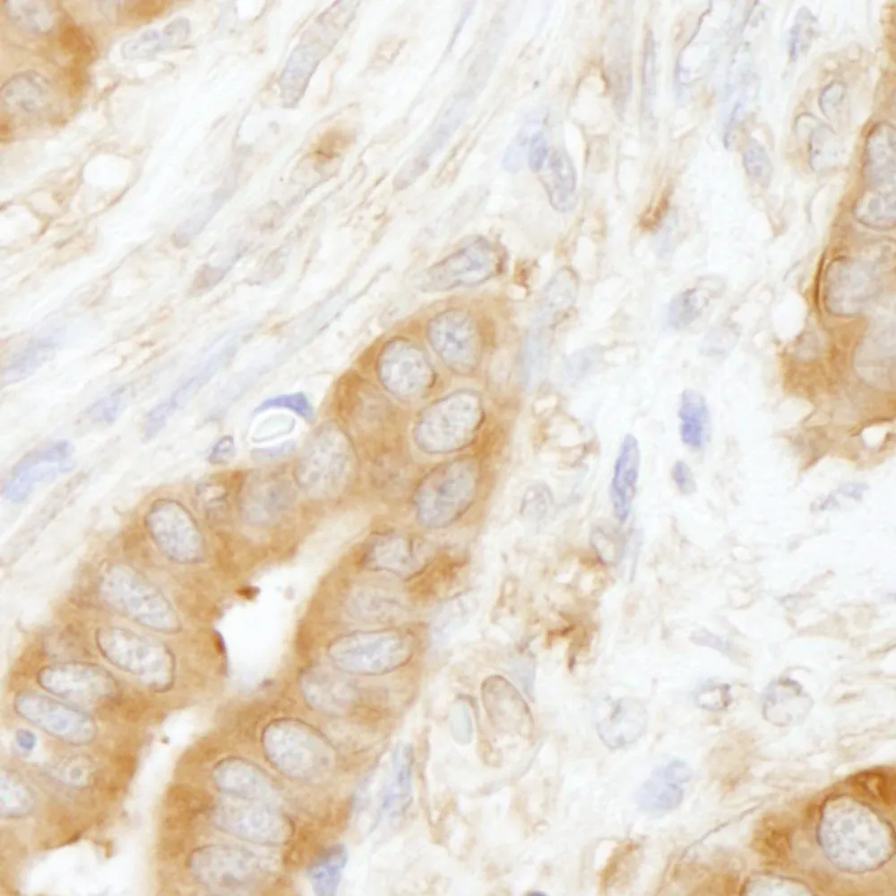 Rabbit anti-Coronin 2 IHC Antibody, Affinity Purified