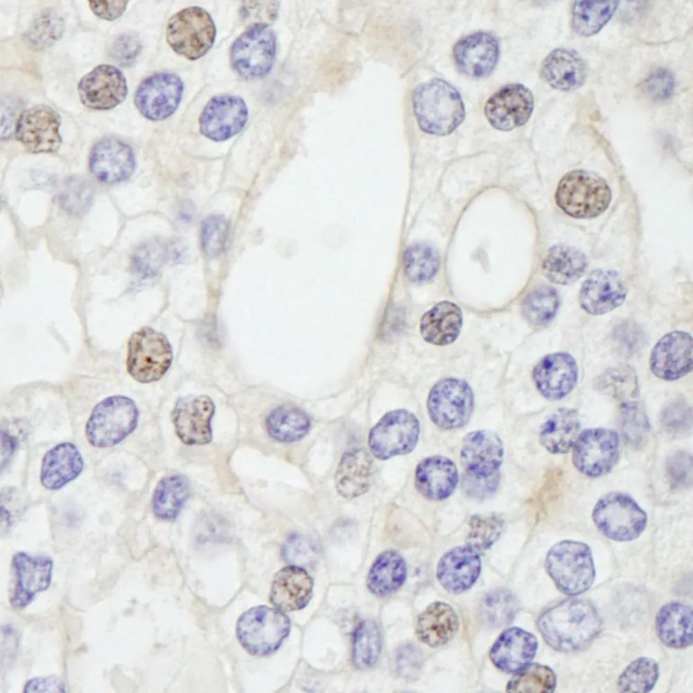Rabbit anti-GTF2IRD/TFII-IRD1 IHC Antibody, Affinity Purified