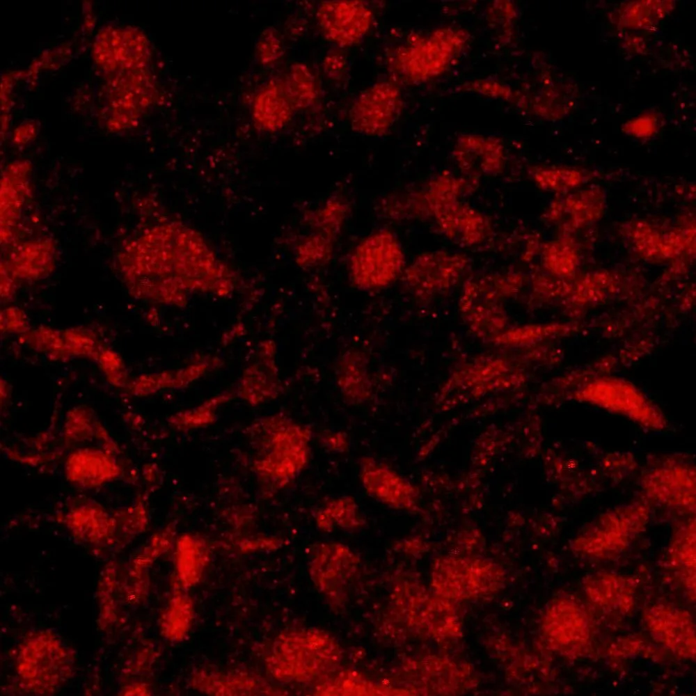 Rabbit anti-BRCA1 IHC Antibody, Affinity Purified