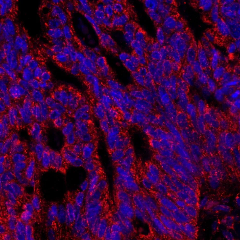 Rabbit anti-AKAP1 IHC Antibody, Affinity Purified