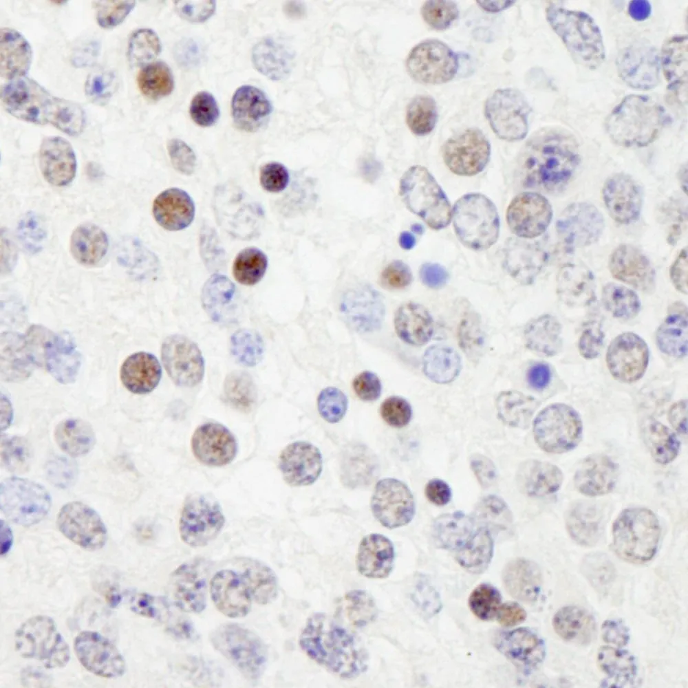 Rabbit anti-WRNIP1 IHC Antibody, Affinity Purified