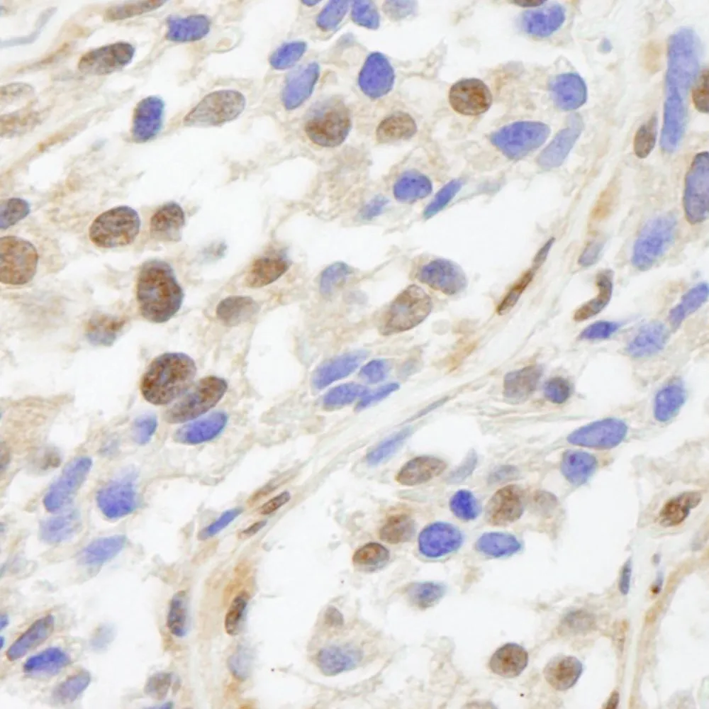 Rabbit anti-UACA IHC Antibody, Affinity Purified